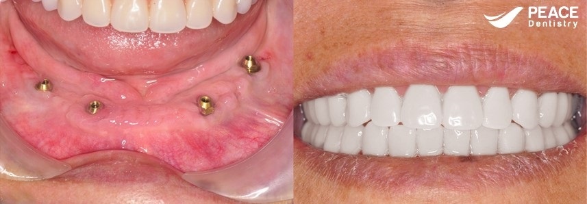 Peace Dentistry ảnh 3 Peace Dentistry anh 3