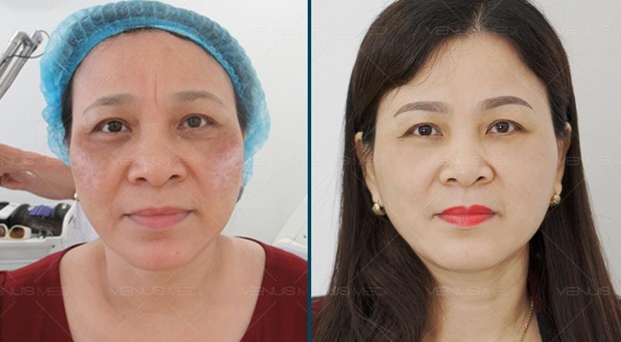Venus Medi ảnh 2 Venus Medi anh 2