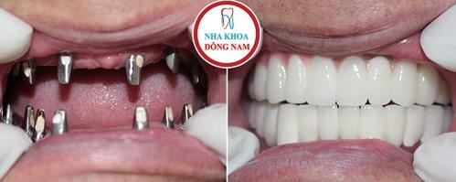 Nha khoa Đông Nam ảnh 2 Nha khoa Dong Nam anh 2