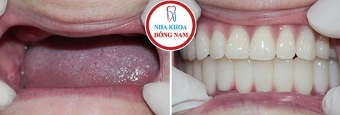 Nha khoa Đông Nam ảnh 5 Nha khoa Dong Nam anh 5