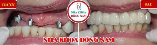 nha khoa Đông Nam ảnh 3 nha khoa Dong Nam anh 3
