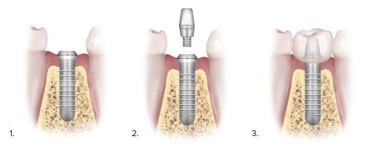 nha khoa Đông Nam ảnh 5 nha khoa Dong Nam anh 5
