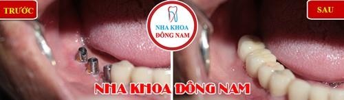 Nha khoa Đông Nam ảnh 2 Nha khoa Dong Nam anh 2