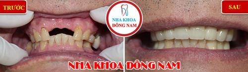 Nha khoa Đông Nam ảnh 3 Nha khoa Dong Nam anh 3