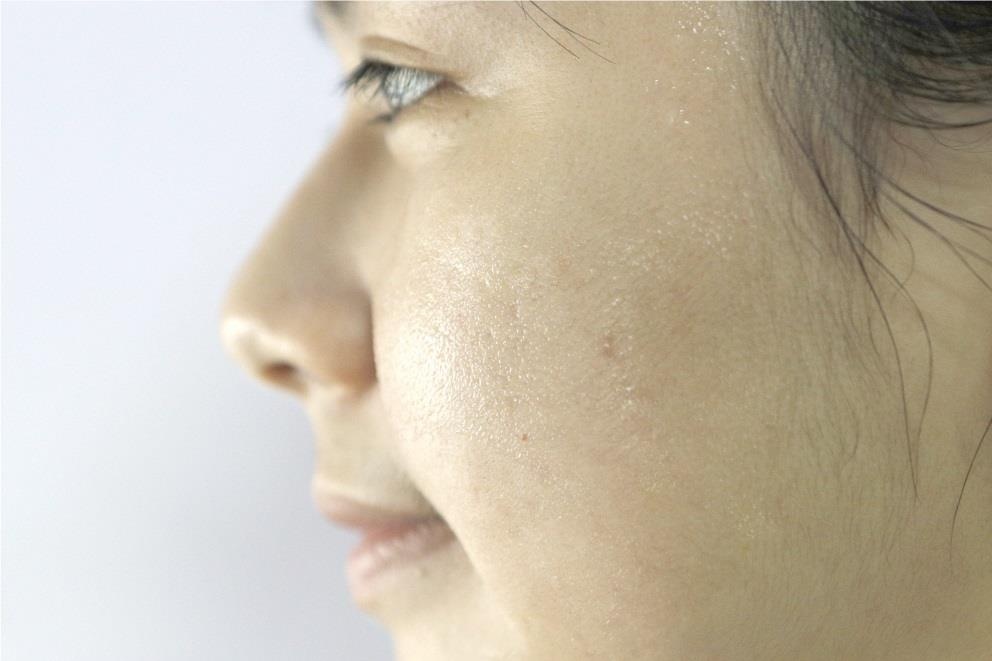 Tẩy tế bào chết ảnh 1 Tay te bao chet anh 1