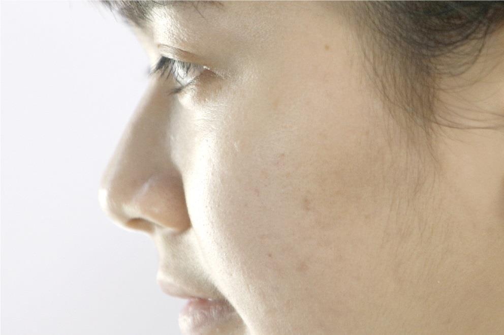 Tẩy tế bào chết ảnh 5 Tay te bao chet anh 5