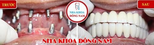 Nha khoa Dong Nam anh 2