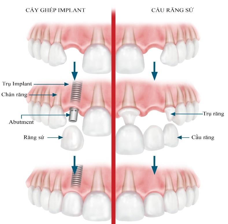 Nha khoa Dong Nam anh 3