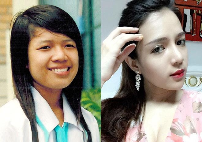 phau thuat tham my anh 5