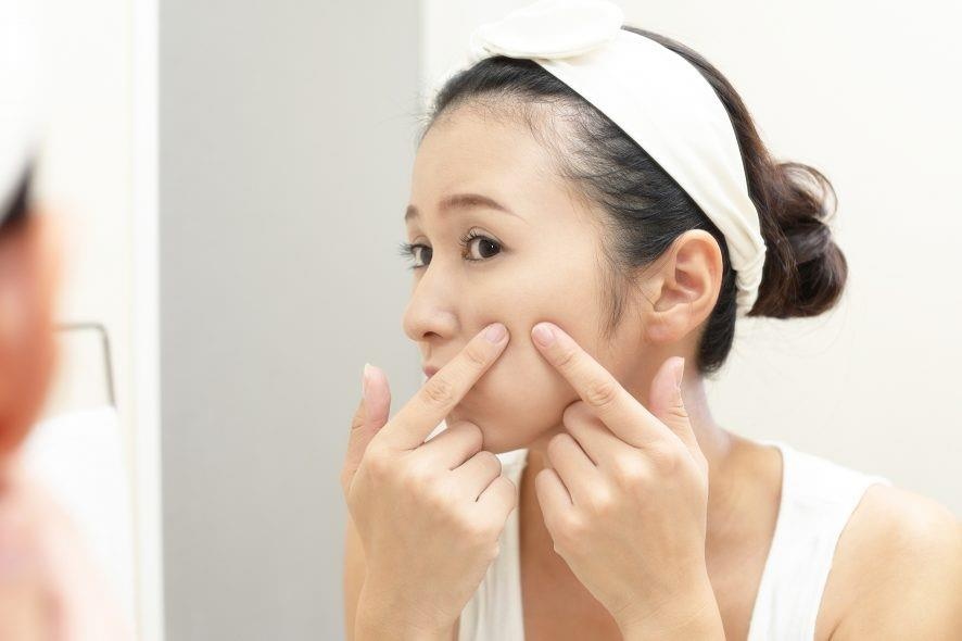 Cach tri mun dau den, mun cam, mun boc hinh anh