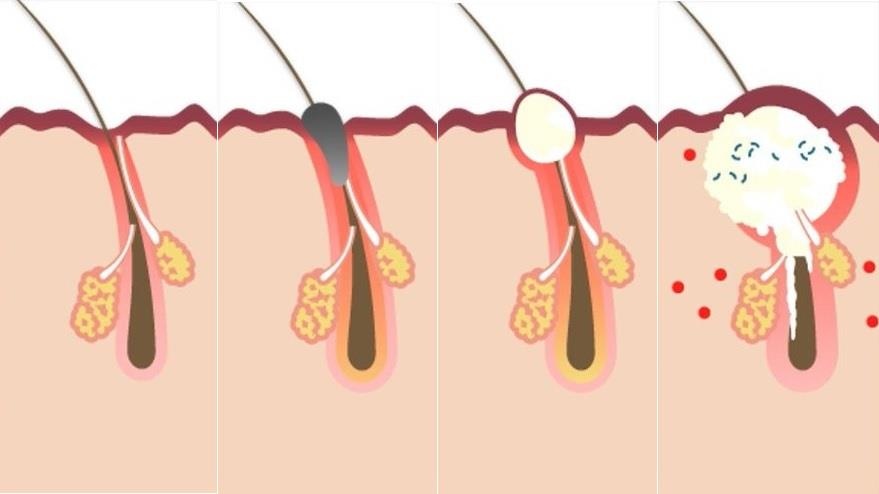 Cong ty TNHH Metaco Truong Van anh 1