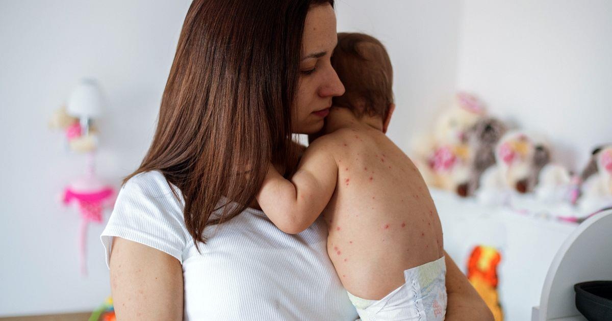 7 ngay cung con chien dau voi benh soi hinh anh