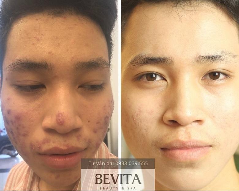 Bevita Beauty & Spa anh 1
