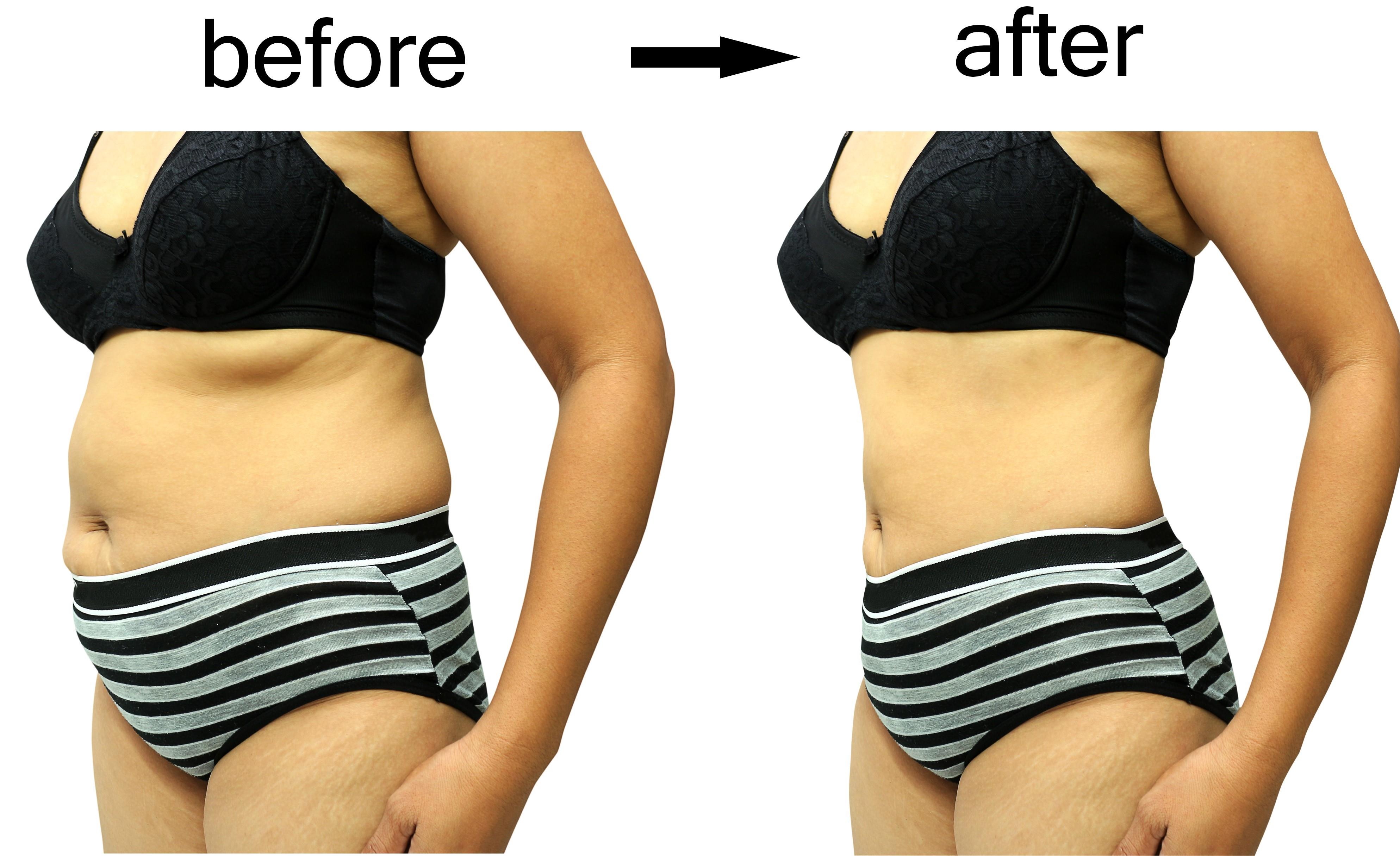 thẩm mỹ Ngọc Phú ảnh 3 tham my Ngoc Phu anh 3