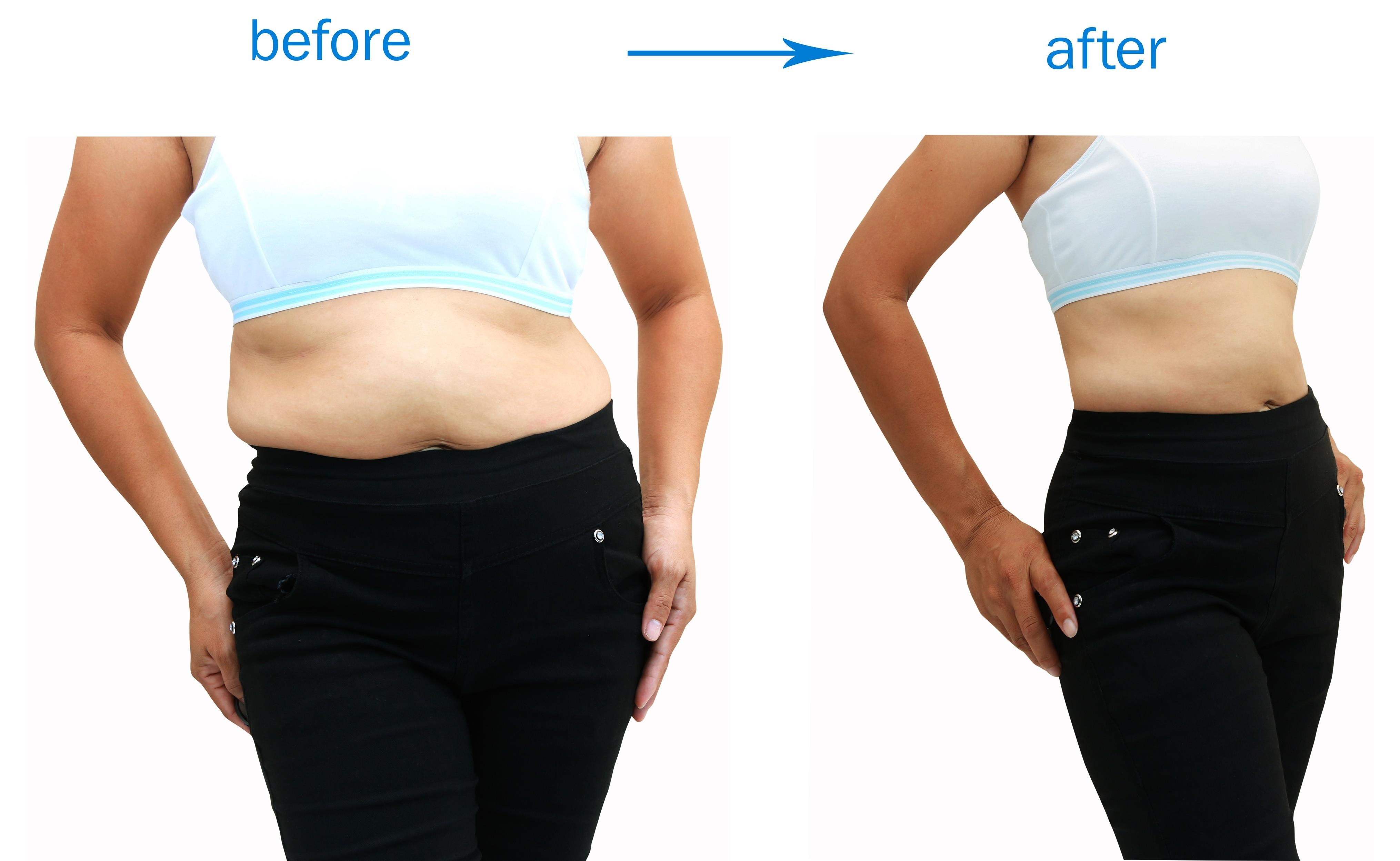 thẩm mỹ Ngọc Phú ảnh 4 tham my Ngoc Phu anh 4