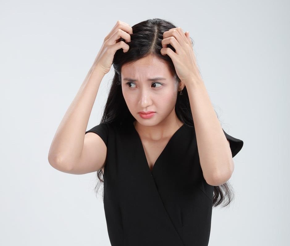 dầu gội trị gàu ảnh 2 dau goi tri gau anh 2