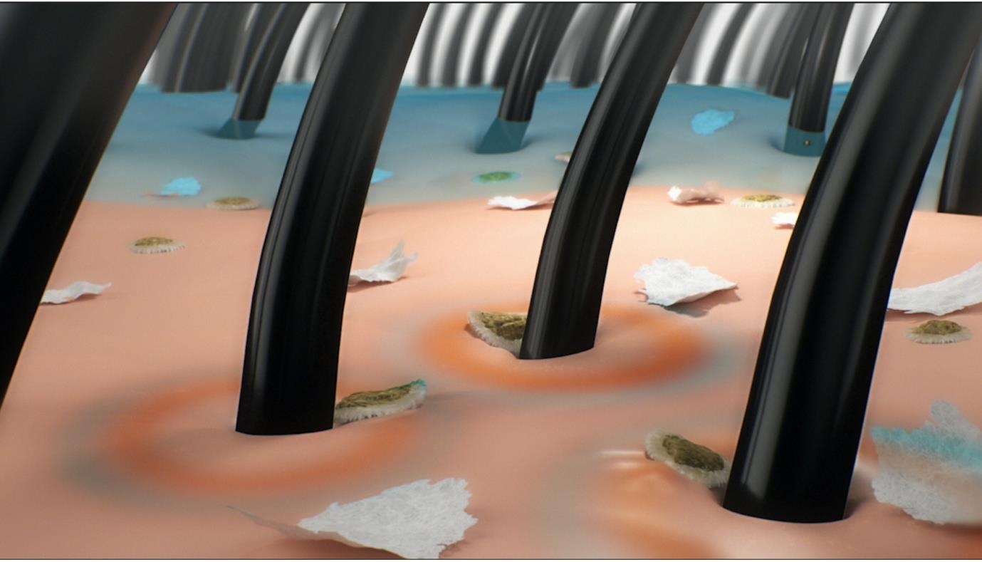 dầu gội trị gàu ảnh 1 dau goi tri gau anh 1