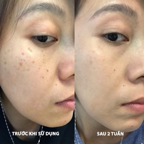 Eucerin ảnh 2 Eucerin anh 2