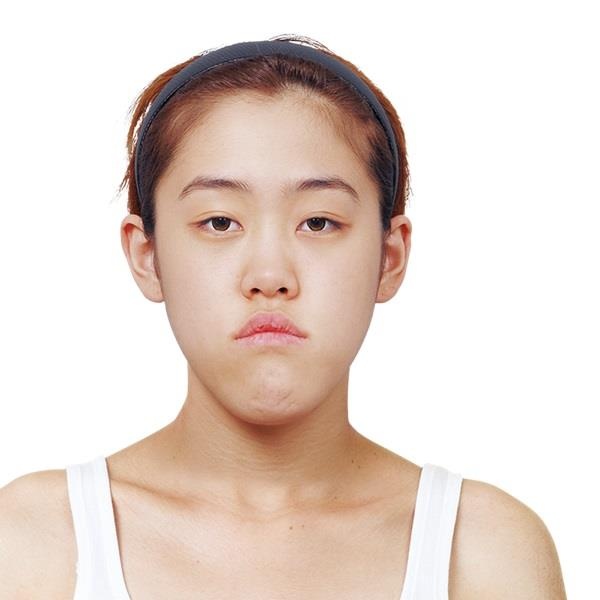 Vinmec ảnh 1 Vinmec anh 1