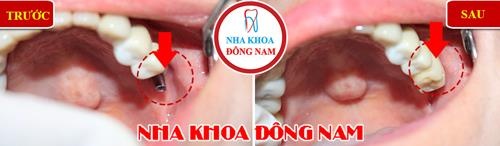 Nha khoa Dong Nam anh 4