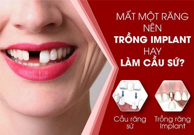 Nha khoa Dong Nam anh 5