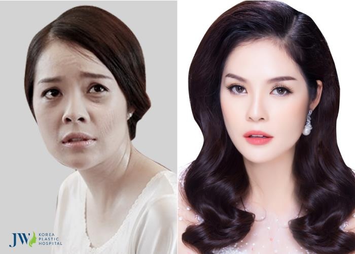 JW Hàn Quốc ảnh 4 JW Han Quoc anh 4