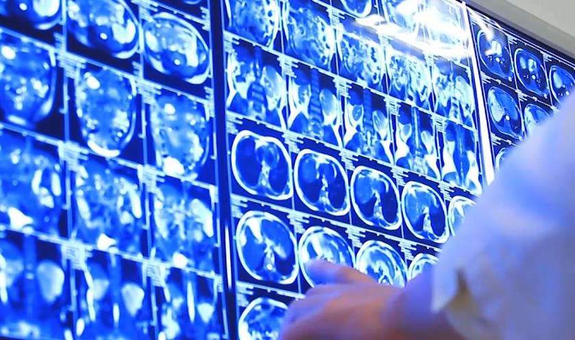 Video -  Quy VINIF tai tro 124 ty cho 20 du an khoa hoc va cong nghe hinh anh