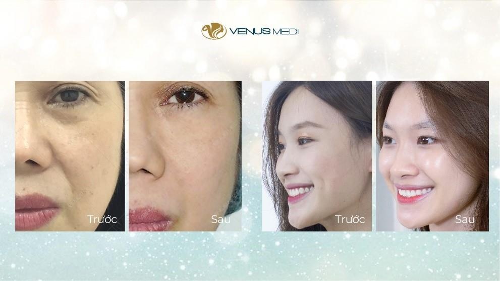 Vien tham my Venus Medi anh 4