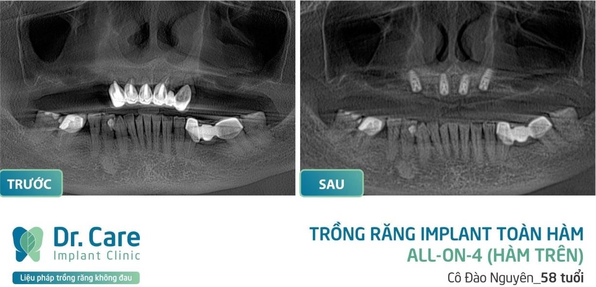 Dr. Care ảnh 2 Dr. Care anh 2