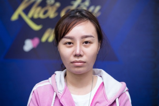 phẫu thuật ảnh 2 phau thuat anh 2