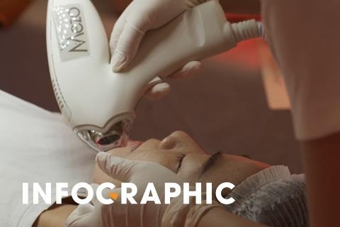 Mezo - cong nghe trieu do trong dieu tri ro, nam hinh anh