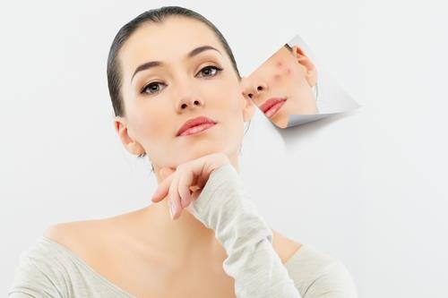 Bi quyet tri mun cho da nhon, de kich ung hinh anh