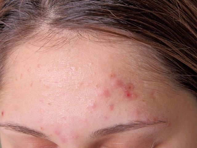 Decumar ảnh 1 Decumar anh 1