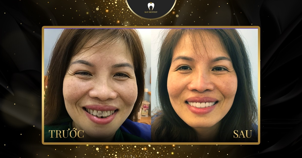 Nha khoa Quoc te Kay anh 2