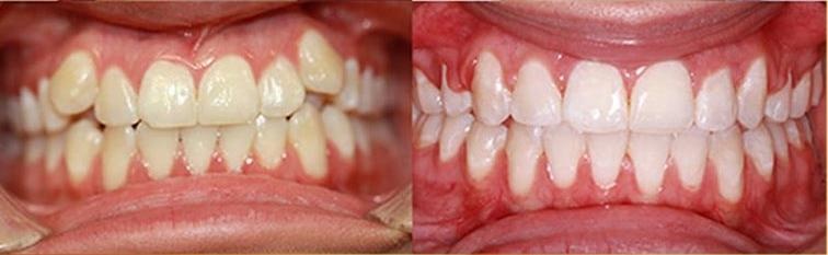 Nha khoa Quoc te Kay anh 1