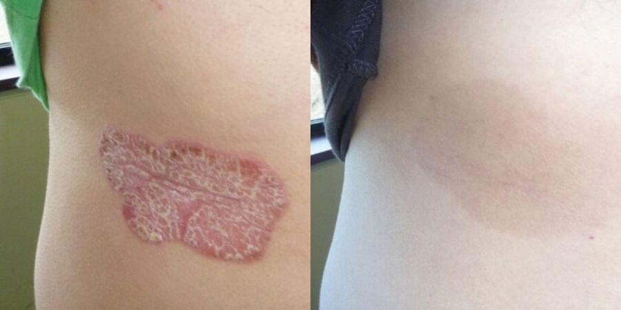 Dr. Michaels ảnh 2 Dr. Michaels anh 2