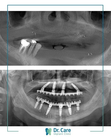Dr. Care ảnh 2 Dr. Care anh 2