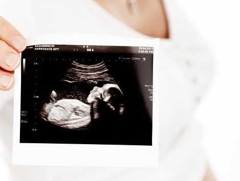 Bibabo ảnh 3 Bibabo anh 3