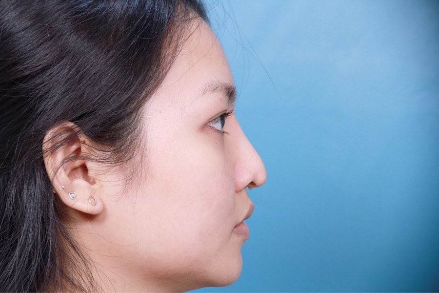 Vien tham my La Ratio anh 3