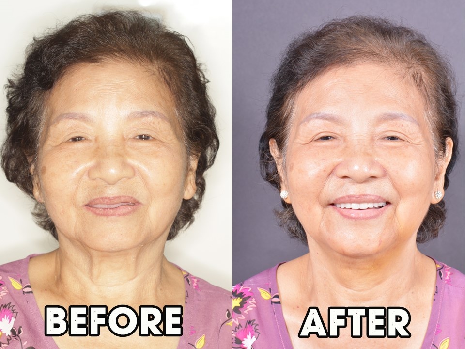 Benh vien Tham my - Rang Ham Mat Worldwide anh 1