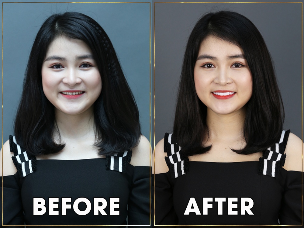 Bệnh viện Thẩm mỹ Răng Hàm Mặt Worldwide ảnh 1 Benh vien Tham my Rang Ham Mat Worldwide anh 1