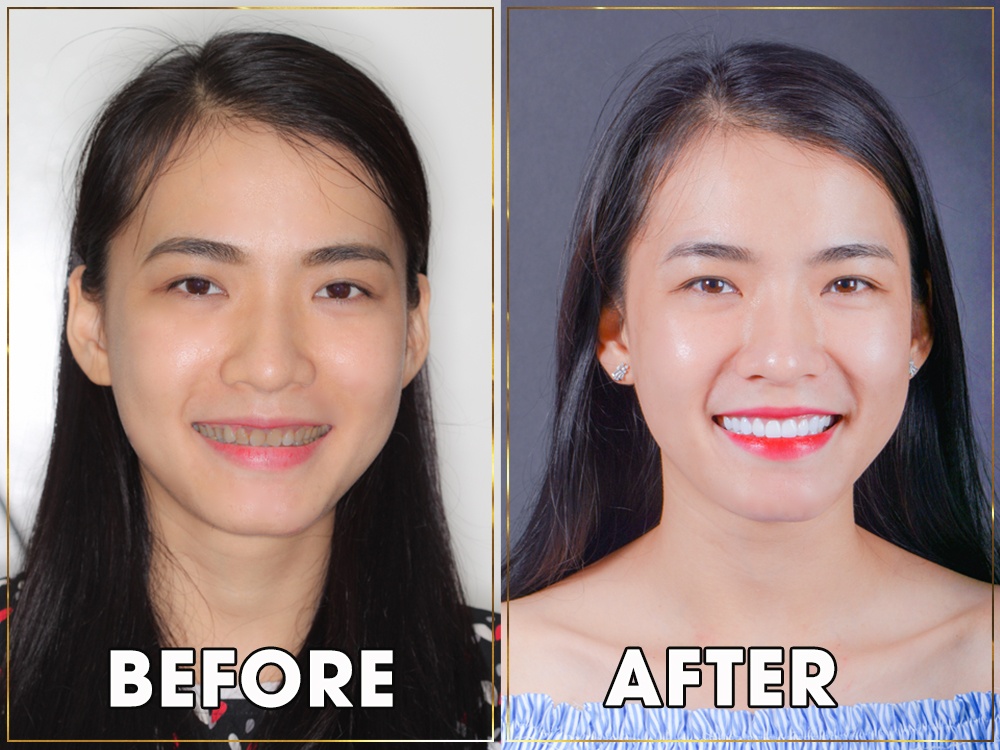 Bệnh viện Thẩm mỹ Răng Hàm Mặt Worldwide ảnh 2 Benh vien Tham my Rang Ham Mat Worldwide anh 2