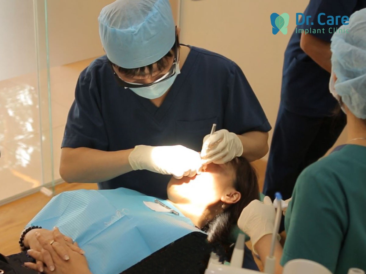 Trong rang Implant anh 2