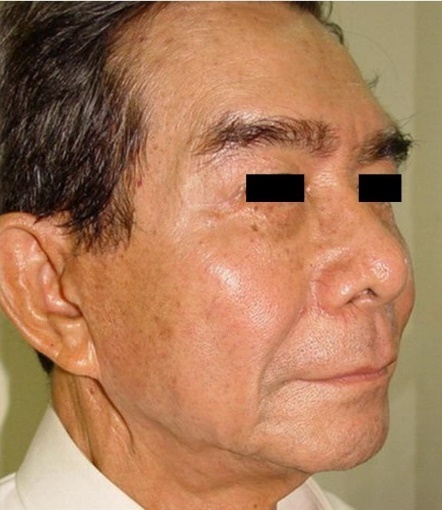 thẩm mỹ nội khoa ảnh 5 tham my noi khoa anh 5