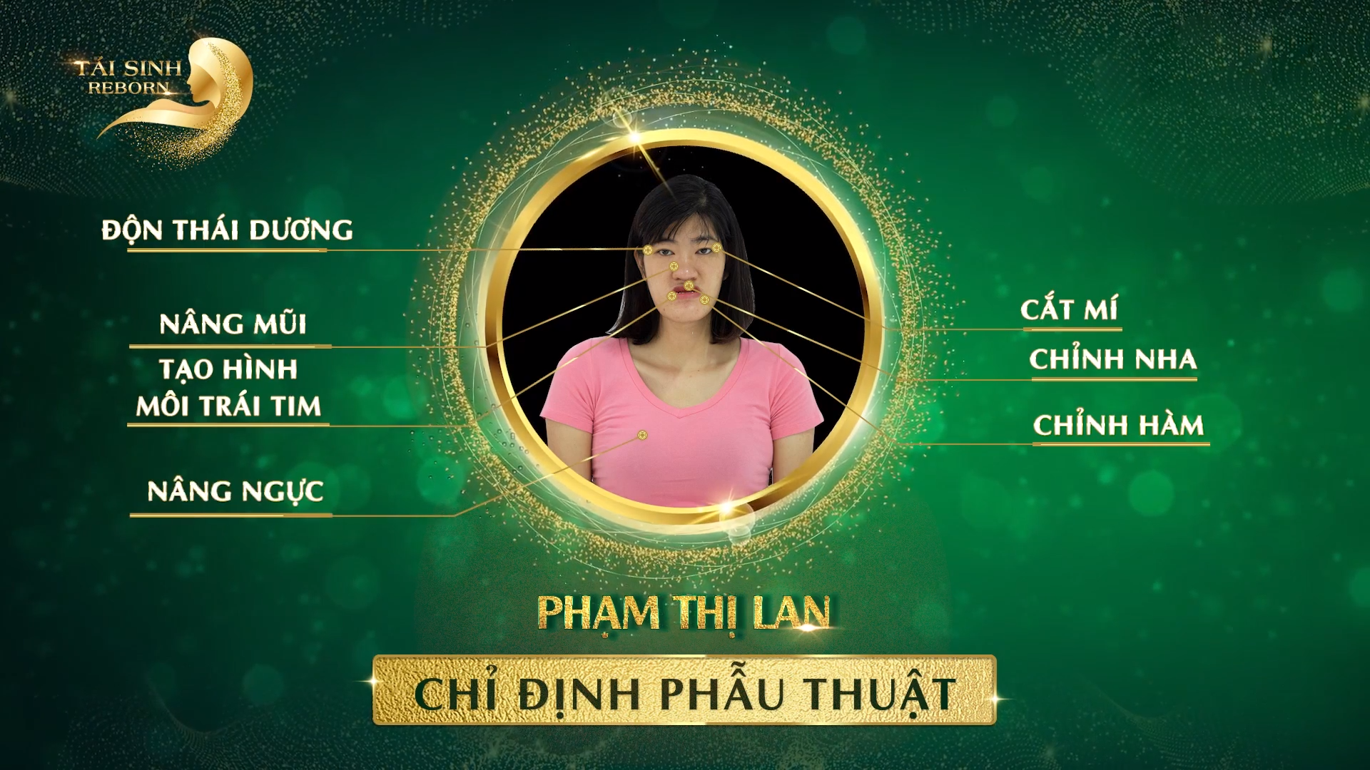 He thong tham my Quoc te Thu Cuc anh 7