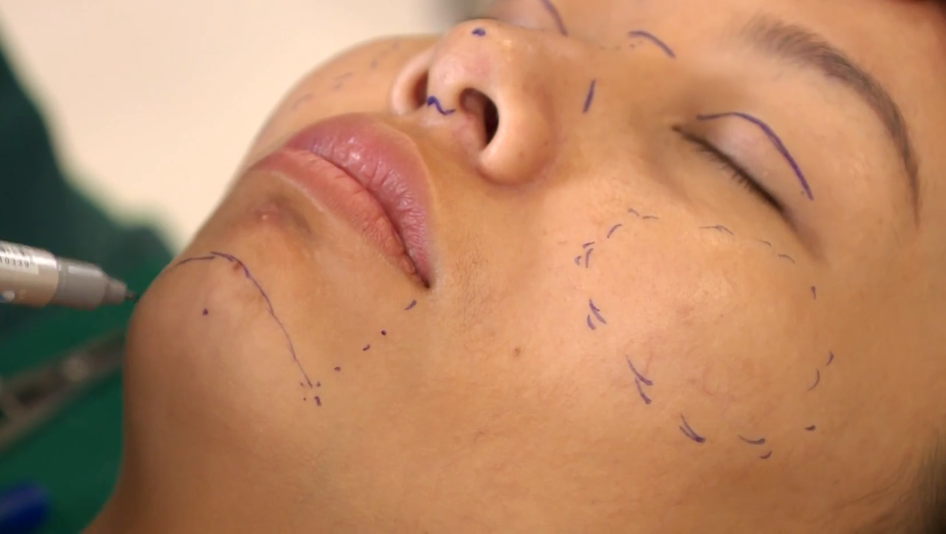 Thu Cúc ảnh 4 Thu Cuc anh 4