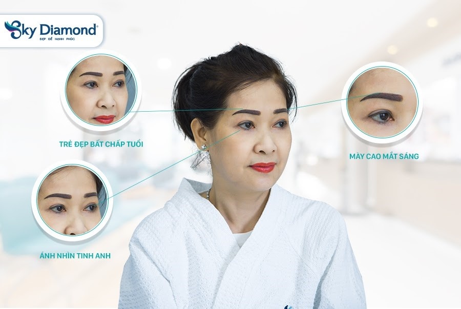 Vo chong vu su mien Tay cai thien nhan sac nho cong nghe treo may hinh anh