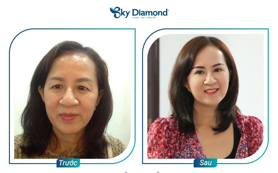 Sky Diamond ảnh 4 Sky Diamond anh 4