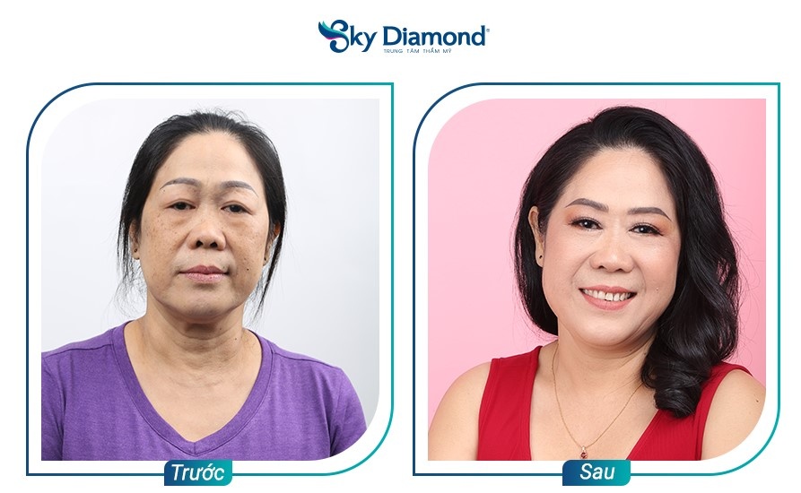 Sky Diamond ảnh 5 Sky Diamond anh 5