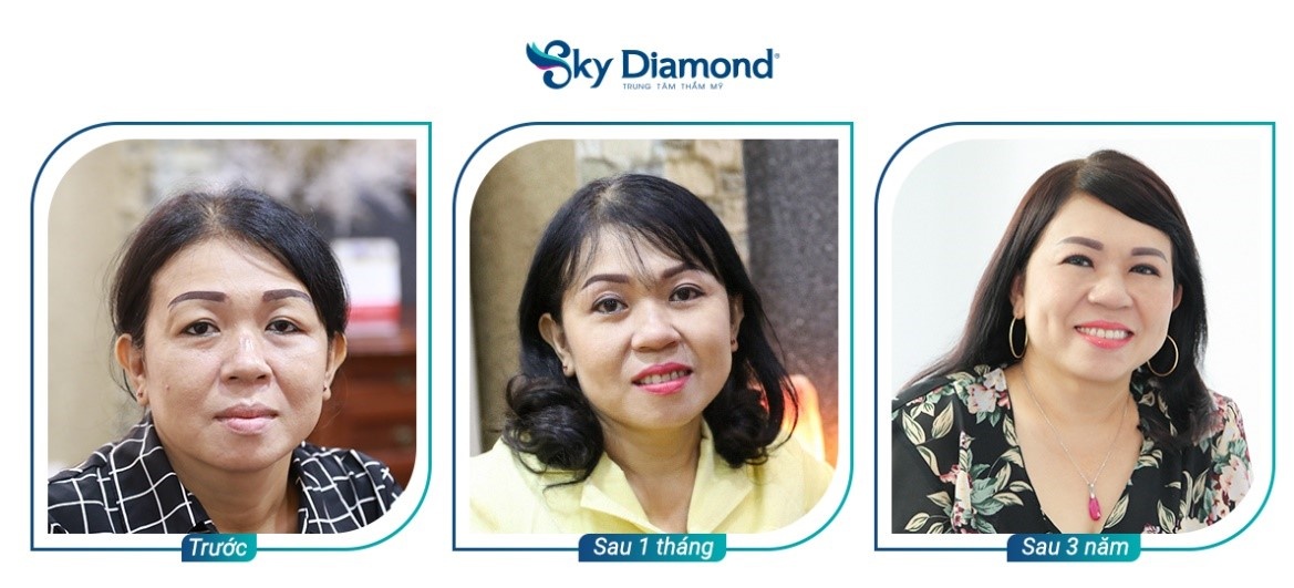 Sky Diamond anh 6